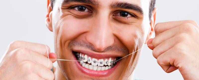 nitkanje ortodontski aparat