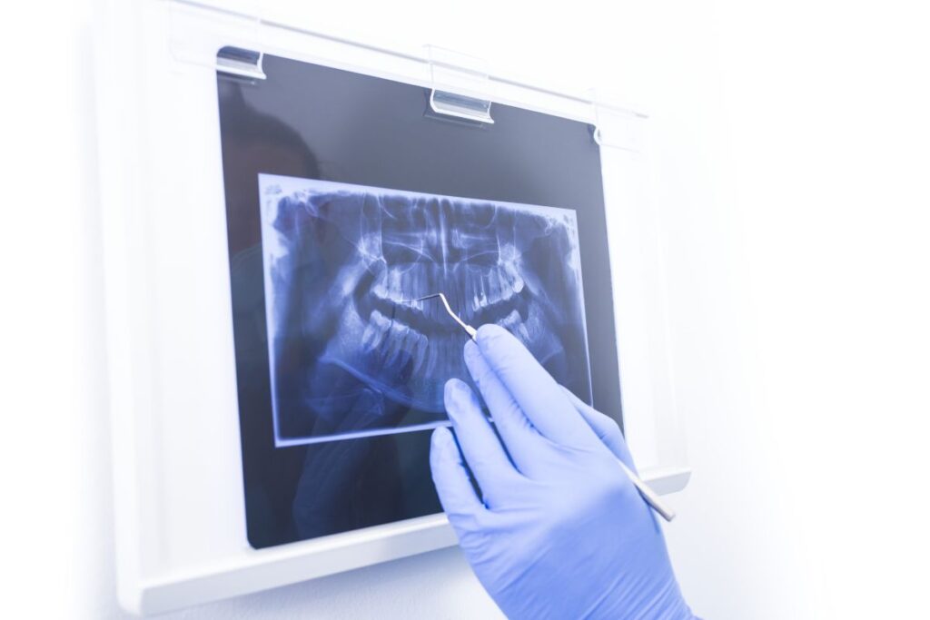 Рентгеновский снимок в рамке с подсветкой. Некачественный рентген снимок. Дизайн папки для рентгеновских снимков.